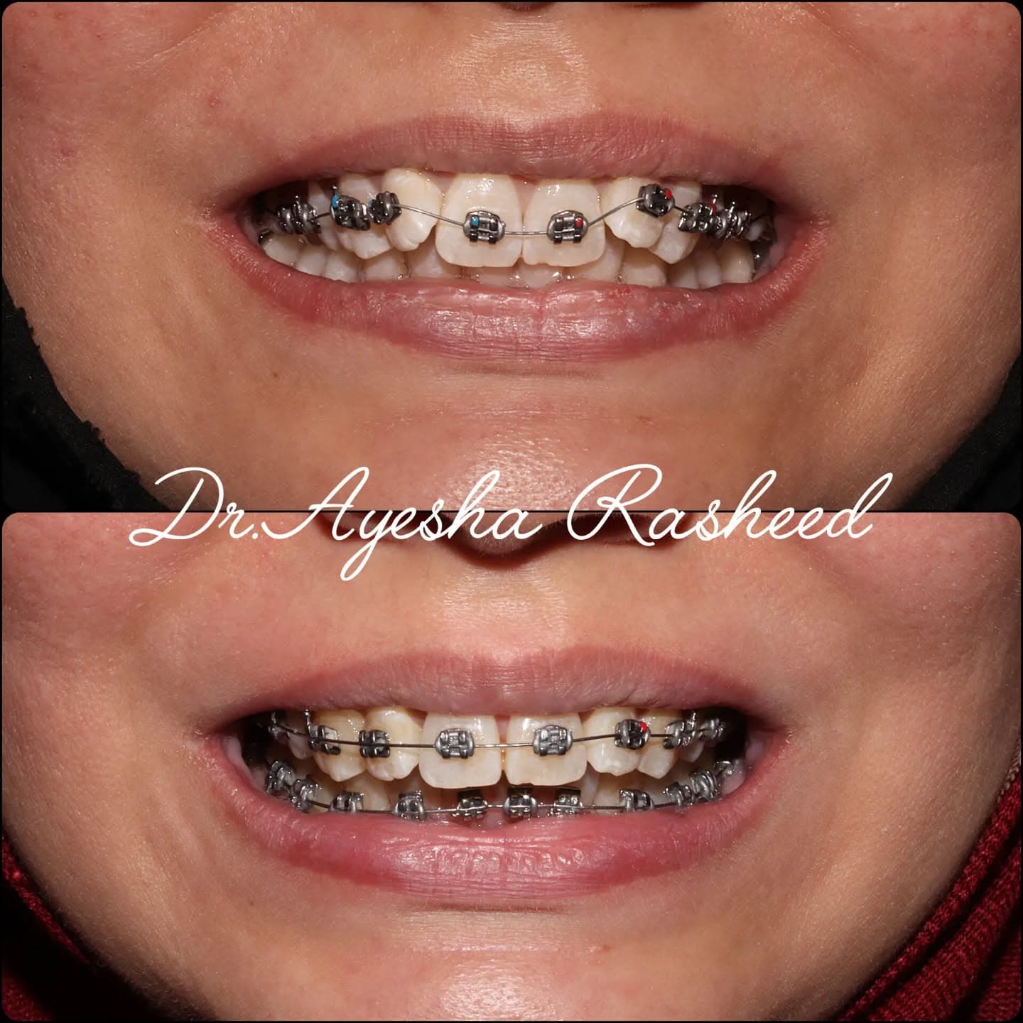 Cosmetic Dentistry