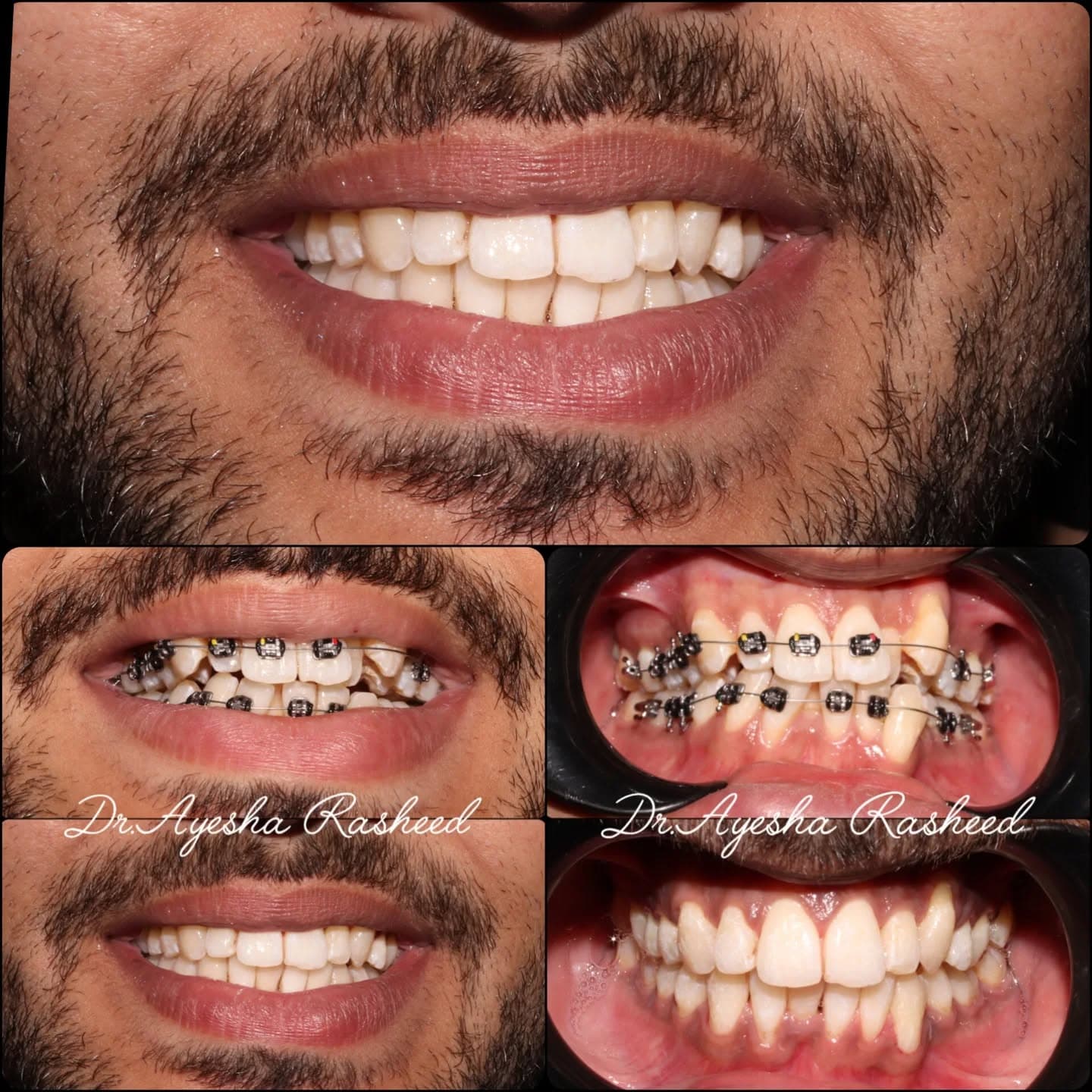 Preventive Dentistry